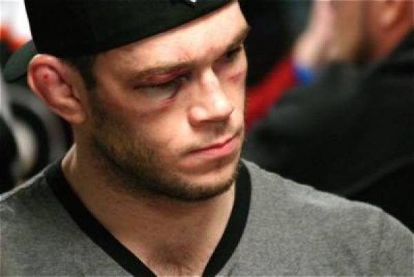 Forrest Griffin UFC 101 Bet