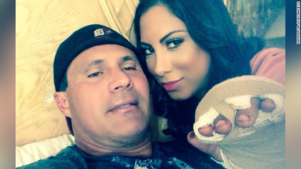 Jose Canseco Finger Falls Off During Poker Tournament Jose Canseco Finger Falls Off During Poker Tournament