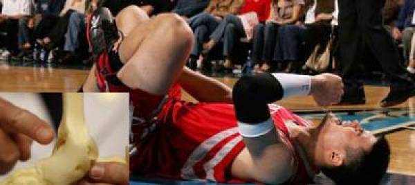 Yao Ming Injury