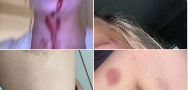 Man United in Disarray as Alleged Domestic Violence Images Surface on Social Media