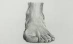 Man Claims Casino Responsible for Amputated Foot Man Claims Casino Responsible for Amputated Foot